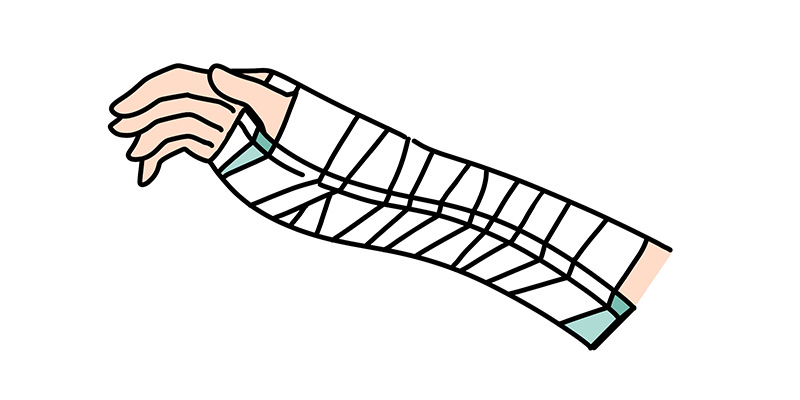 ギブスとシーネ(添木)