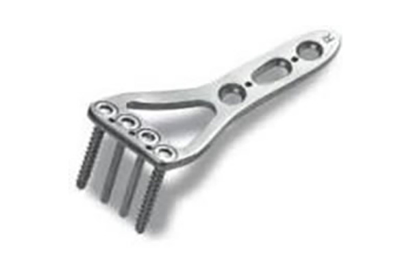 ロッキングプレート