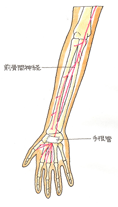 前骨間神経麻痺