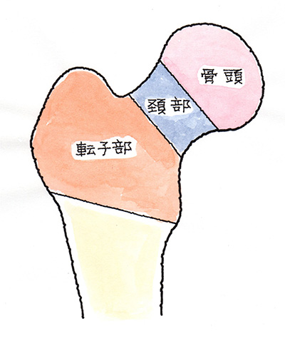大腿骨頭・大腿骨頚部・転子部