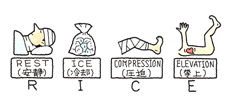RICE(ライス)処置(安静・冷却・圧迫・挙上)