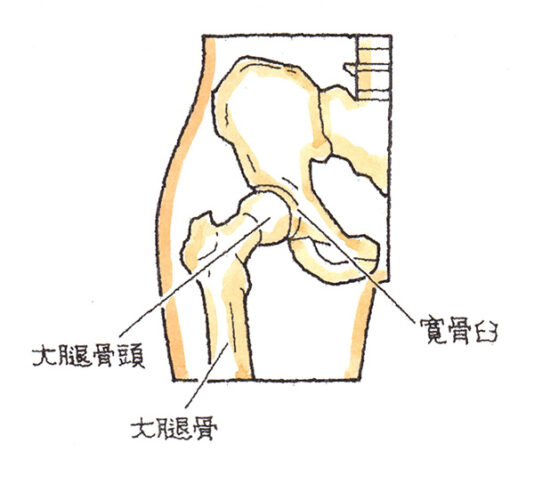 大腿骨頭、寛骨臼、大腿骨
