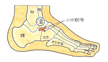 二分靭帯損傷