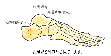 踵骨