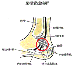 足根管