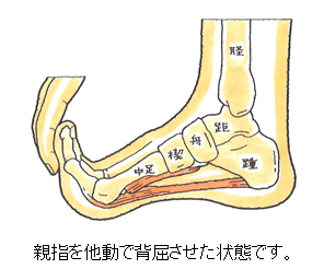 足底腱膜