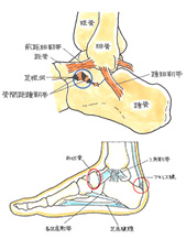 その他足根洞症候群、アキレス腱断裂