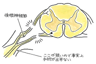 後根神経節