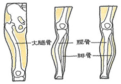 回旋変形癒合