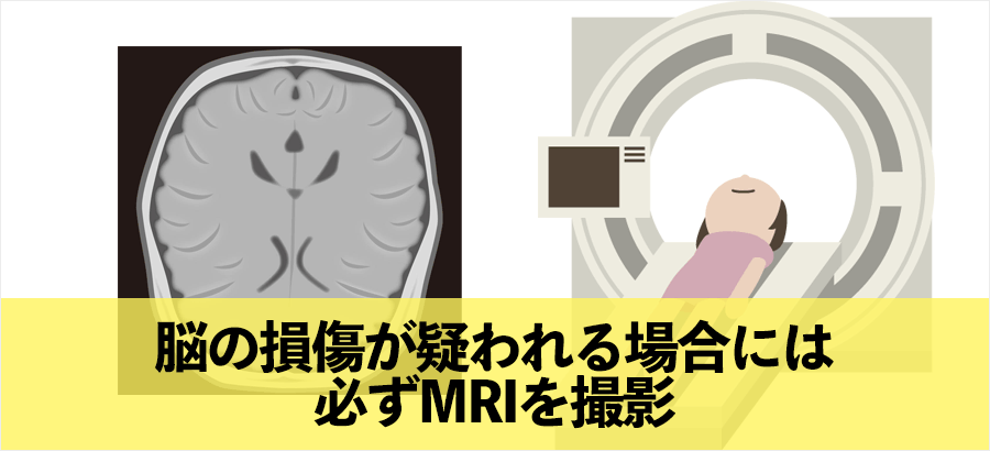 脳の損傷が疑われる場合は必ずMRI検査をしましょう