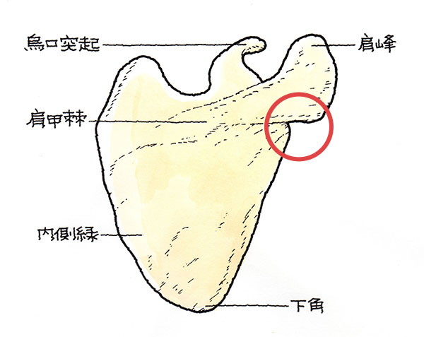 肩甲骨関節窩部骨折