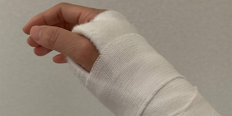 交通事故による右手関節捻挫