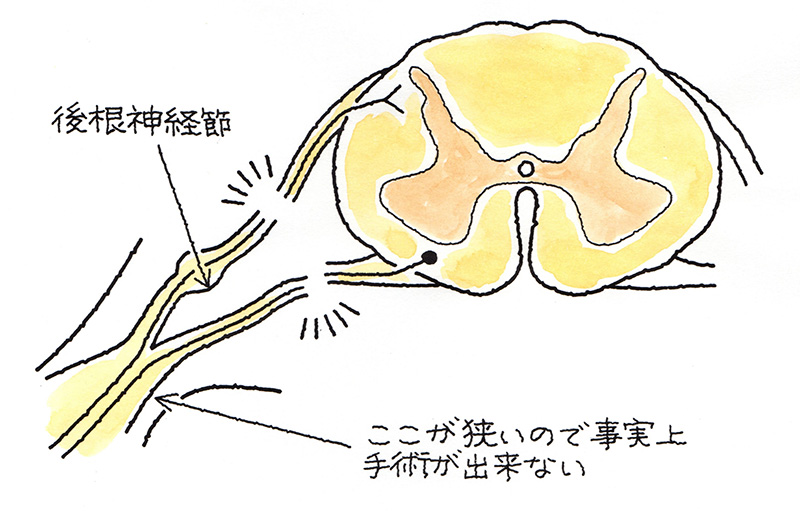 後根神経節